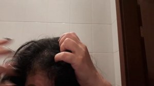 СПРЕЙ ДЛЯ РОСТА ВОЛОС! РАСТУТ ДАЖЕ В МЕСТАХ ПОЛНОГО ОБЛЫСЕНИЯ