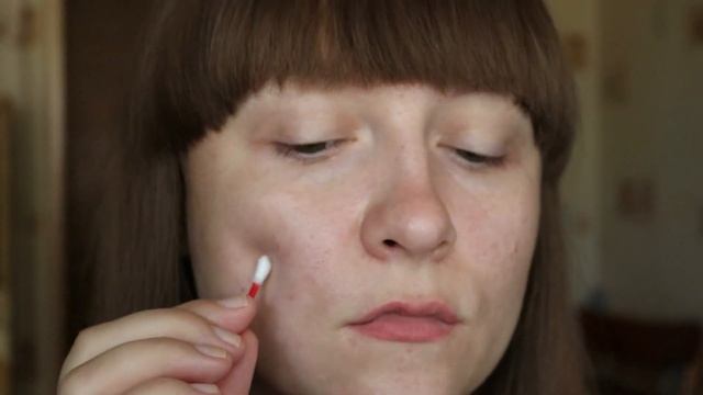 Быстро и легко избавляемся от прыщей в домашних условиях