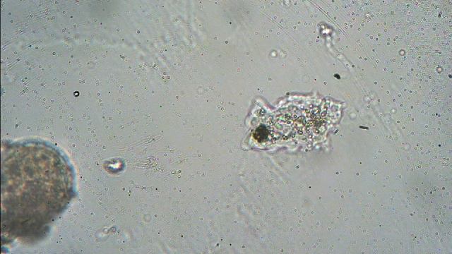 Amoeba proteus смотреть онлайн