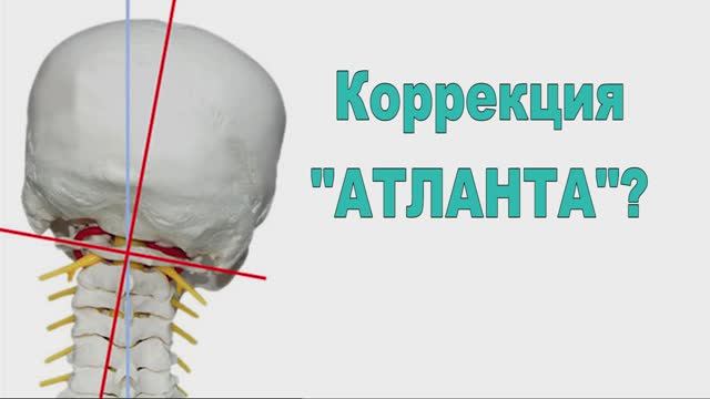 Коррекция "Атланта"? Что нужно знать о так называемой правке атланта, перед тем как идти на приём