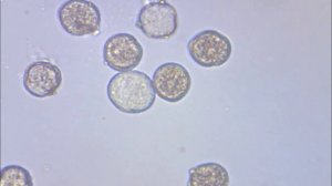 Капля воды под микроскопом р. Вёкса