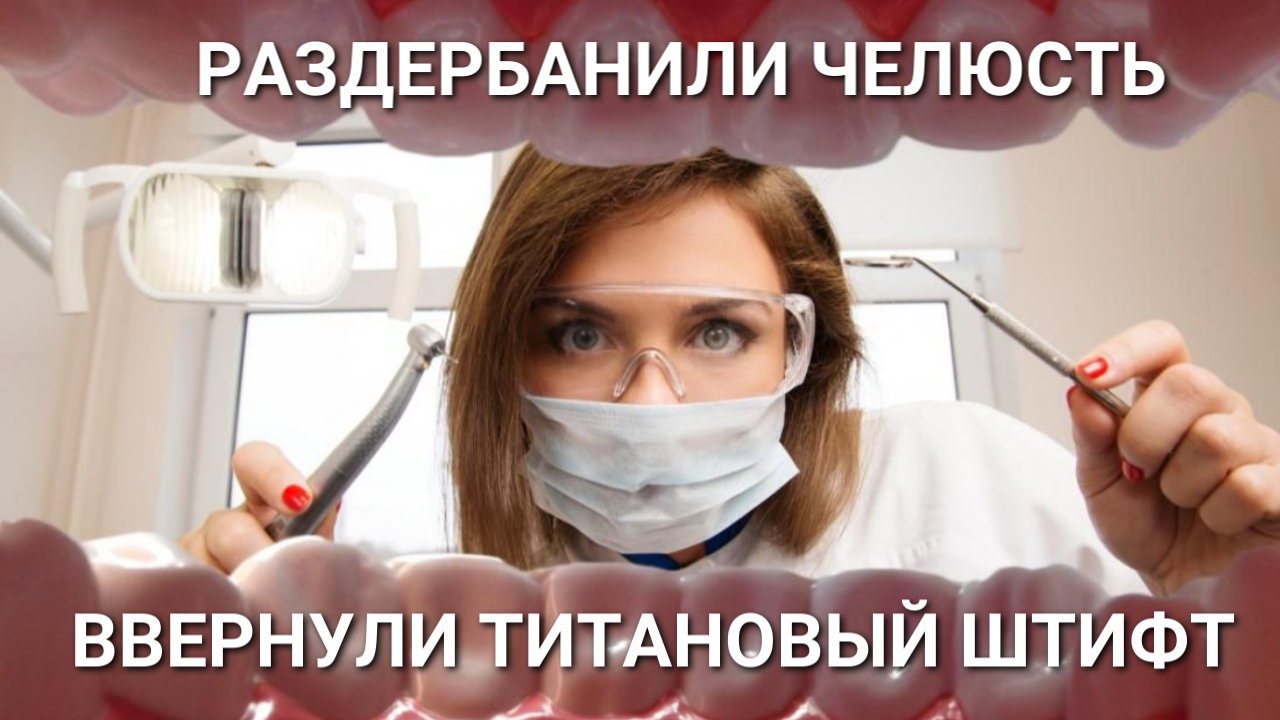 Раздербанили челюсть, ввернули титановый имплант: о пользе визита к стоматологу