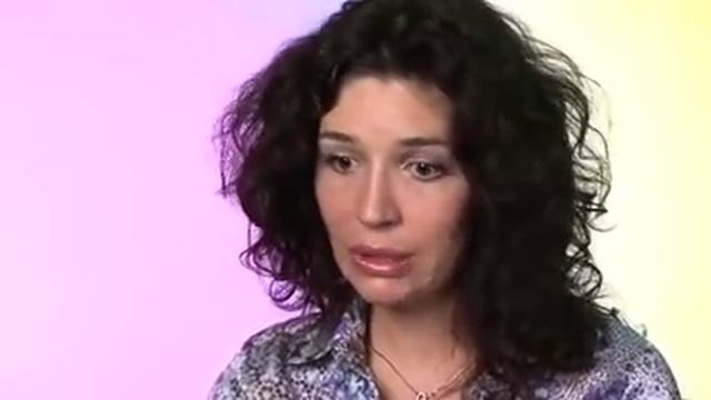Диффузная алопеция (облысение)