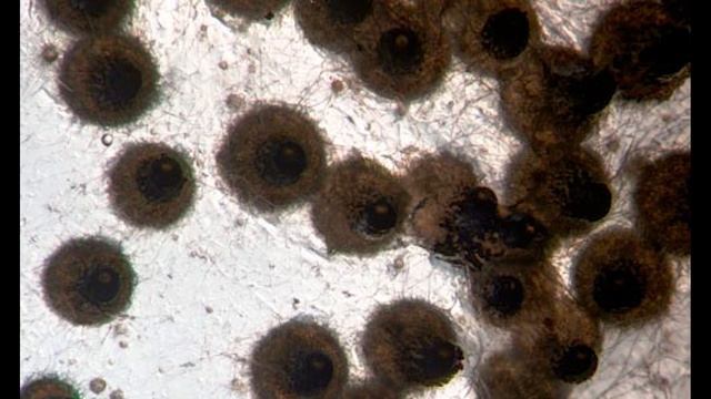 Vegetative / Heterokaryon Incompatibility. Hyphal Anastomosis. How do Fungi recognize each other? смотреть онлайн