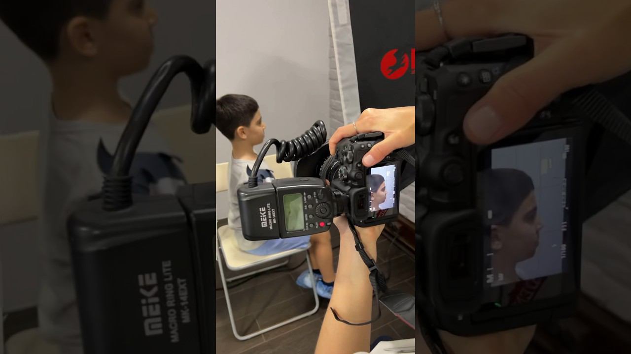 Как проводится фотопротокол лица? ❤️ Стоматология “СТОЛИЦА”  Москва, ЦАО. Круглосуточно!