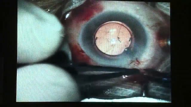 chirurgie 2