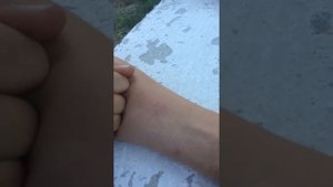 Укус шмеля| BiteRussia