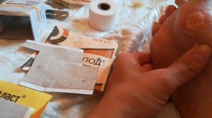 Сухие мозоли, натоптыши. Удаление в домашних условиях.#сухиемозоли#натоптыши#удалениесухихмозолей#