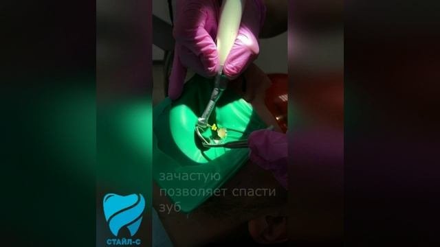 Эндодонтическое лечение