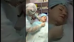 Подтяжка лица нити коги - Салон красоты "12 месяцев"