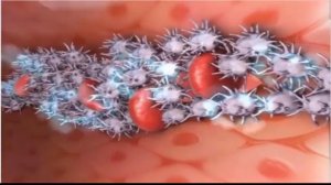 Умумий клиник қон тахлили