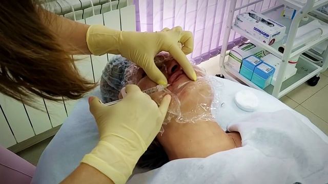 Контурная пластика губ смотреть онлайн