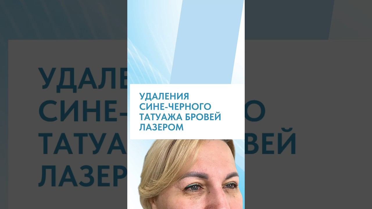 А ВЫ НЕ ВЕРИЛИ | УДАЛИЛИ НЕНАВИСТНЫЙ ТАТУАЖ ЗА ОДИН ВИЗИТ