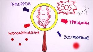 Что такое ГЕМОРРОЙ?
