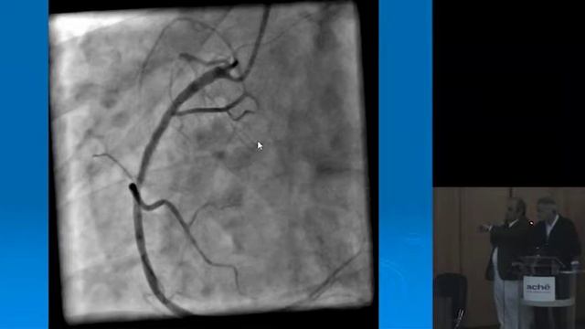 Dor Torácica no Pronto Socorro смотреть онлайн