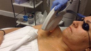 IPL/Laser Rejuvenation