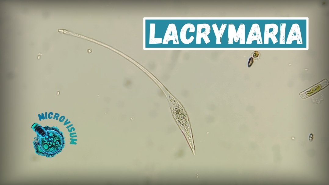 Lacrymaria - хищная инфузория