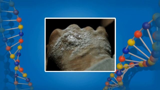 Нарушение кожных покровов и причины повреждения кожи. Видеоурок по биологии 8 класс