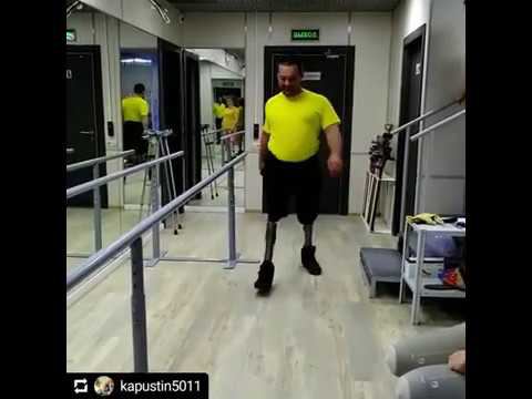 Протезы бедра с внешним источником энергии