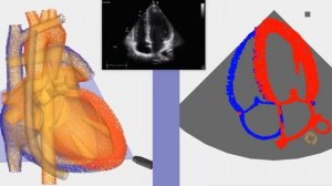 Апикальный доступ 4 х камерное сечение сердца