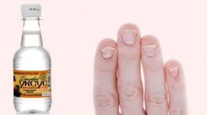 8 СПОСОБОВ быстро избавиться от ГРИБКА на ногтях