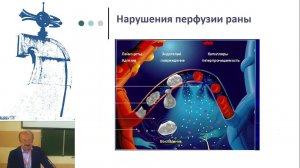 Анестезия, анальгезия и хирургическая инфекция