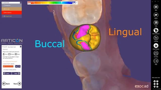 exocad chairside & i500 смотреть онлайн