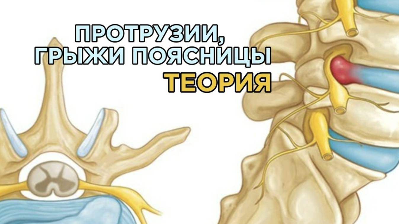 ПРОТРУЗИИ, ГРЫЖИ И ОСТЕОХОНДРОЗ ПОЯСНИЦЫ. Теория