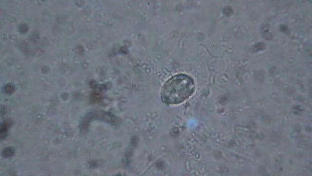 Что можно увидеть в микроскоп - вода из реки смотреть онлайн