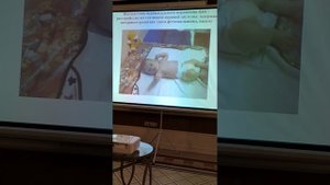 Перинатальное поражение ЦНС