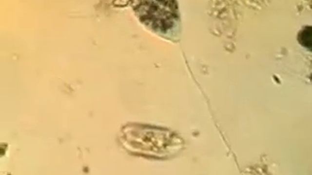 Движение инфузорий 2 смотреть онлайн