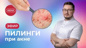 ПИЛИНГИ для борьбы с акне и постакне | Кислоты для проблемной кожи