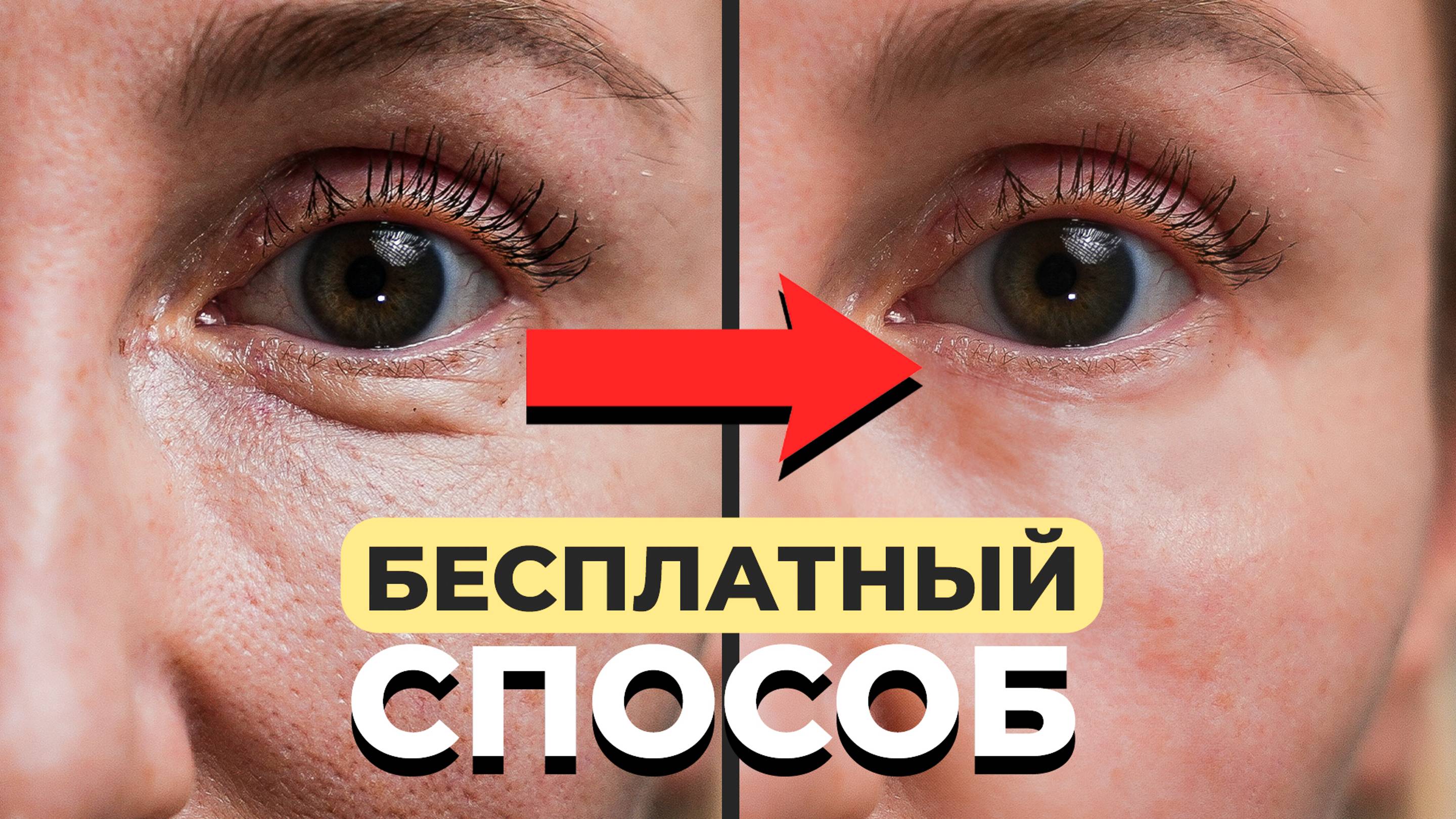 5 советов по уходу за кожей вокруг глаз