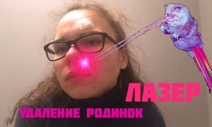 Моя история удаления родинок ЛАЗЕРОМ