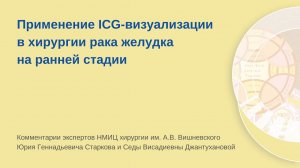 ICG-флуоресценция при лимфаденэктомии у пациента с ранним раком желудка