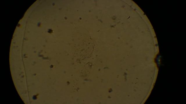 пыльца цветка цинния под микроскопом смотреть онлайн