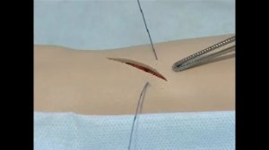 Наложение швов на кожу