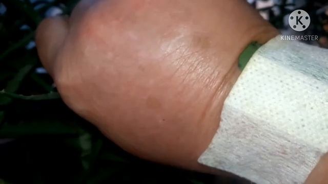 Алоэ для раны#рецепт заживления смотреть онлайн