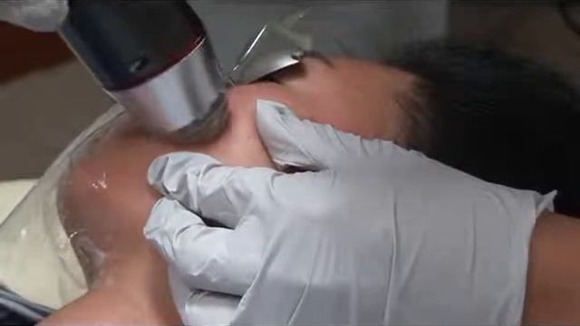 Infini Procedure