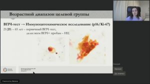 Скрининг рака шейки матки. Стратегии проведения