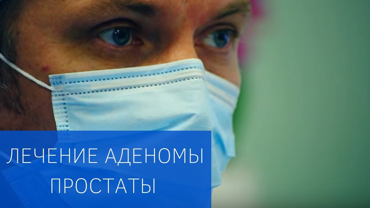 Эмболизация простатических артерий