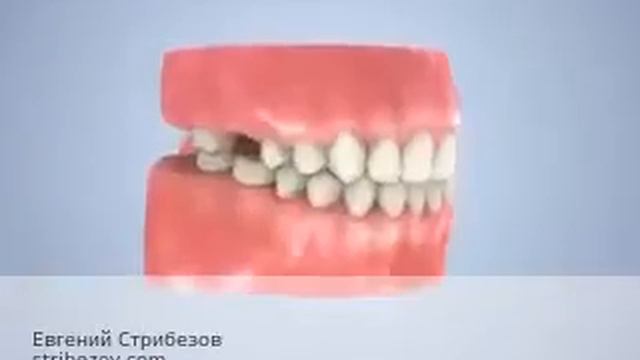 Бюгельный протез цена