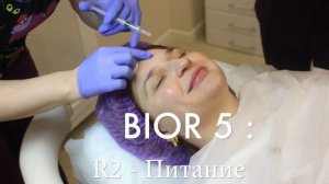 3D Биоревитализация BIOR 5