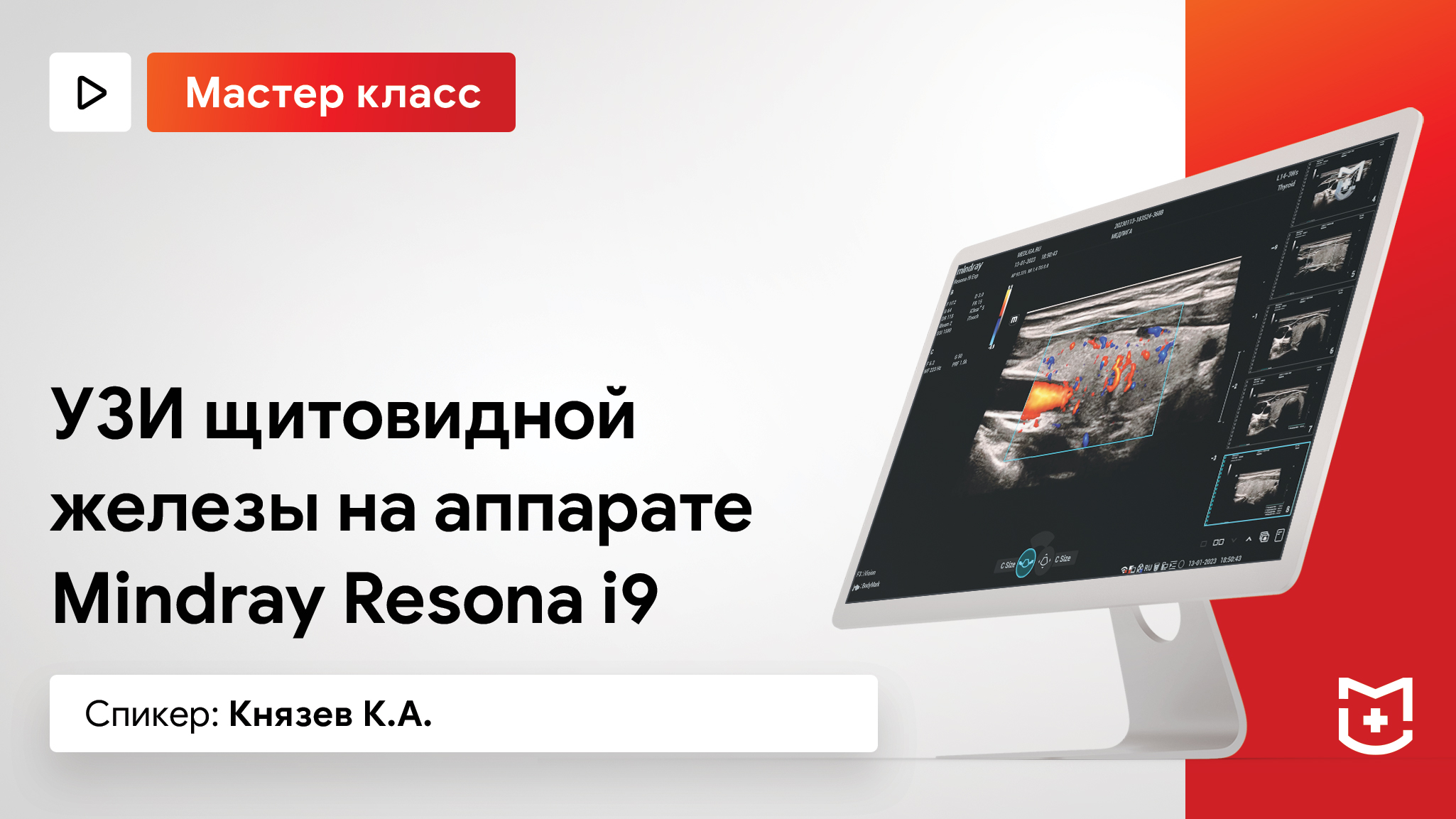 УЗИ щитовидной железы на Mindray Resona I9