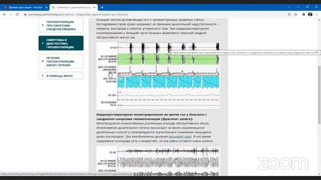 Нормальное дыхание, дыхание Бутейко, метод ВЛГД / Часть 23 смотреть онлайн