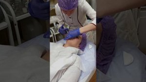 АирисКом студенты учатся: семинар по коррекции кисетных морщин, филлер.
