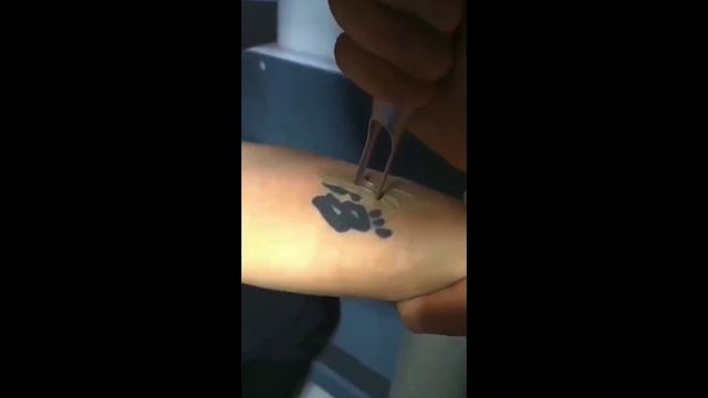 HONKON PICO LASER Tattoo Removal Champion смотреть онлайн