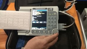 Передача ЭКГ в режиме GSM на 12- канальном аппарате