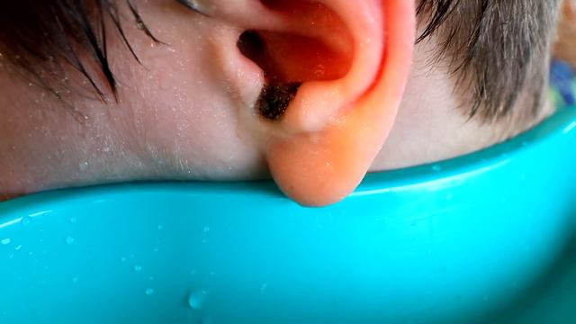 FUN EARWAX REMOVAL (He Could Barely Hear Before We Started) | Dr. Paul смотреть онлайн