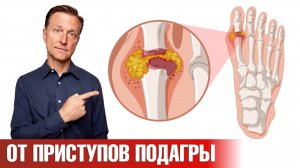 Средство №1 от приступов подагры, которое есть у каждого👍